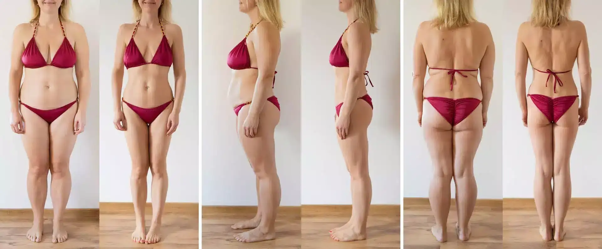 Real Stories: Transformations with Miami Liposuction