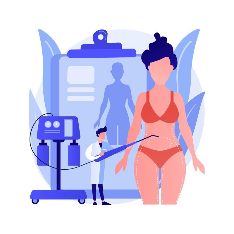 Real Advantages of VASER Liposuction
